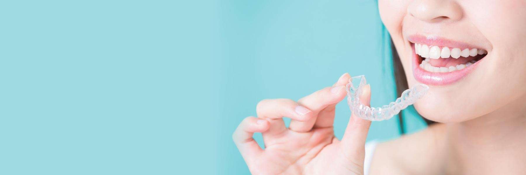 Clear Aligners | Dentist